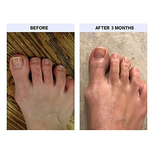 Pumice Stone for Feet - 300 PCS/Box Disposable Callus Remover for Nail Salon Pedicure (Blue)
