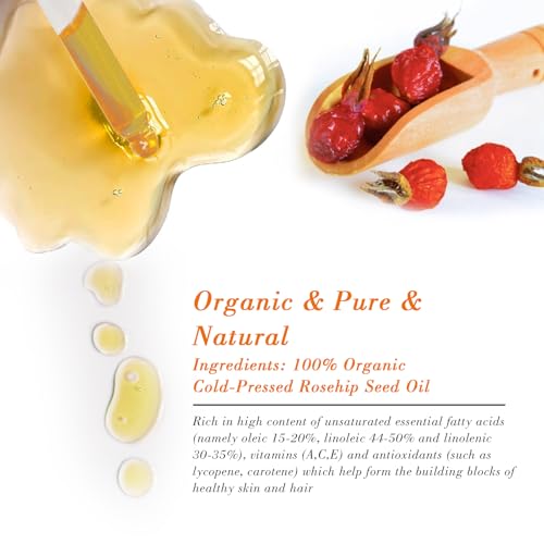 Organic Rosehip Oil for Face & Skin ? USDA Certified, Cold Pressed, Unrefined Rose Hip Seed Oil for Anti-Aging, Scars, Moisturizing, Hair, Nails & Gua Sha Massage, 2 fl oz (60 ml)