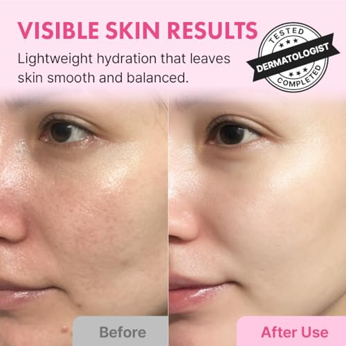 Hanskin Pink Hydration Duo ? Hyaluron Skin Essence & Moisture Cream | Deep Moisture & Soothing Care for Dry, Sensitive Skin | Lightweight Glow Set for Radiant, Dewy Glass Skin | K-Beauty