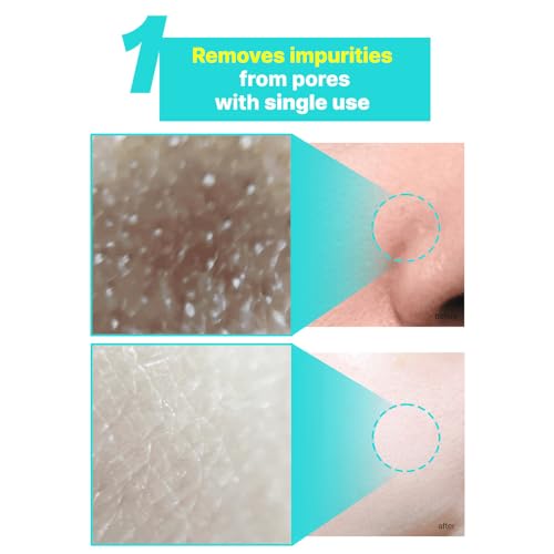 Elishacoy | TETRAFORCE Cica Peeling Toner Pads, Gentle Exfoliating & Calming Toner with Cica, Daily Skin Smoothing & Hydration, Vegan & Dermatologist Tested, 150 mL