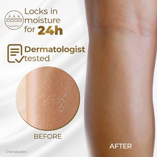 Goicoechea Intense Nourishment Body Lotion with Coconut Oil & Prickly Pear | Womens Lotion for Dry Skin, Body Cream and Moisturizer for Dry Skin, Varicose Veins Cream for Legs, 13.5 fl oz, 1-Pack