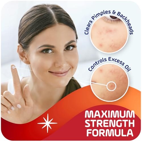 Asepxia 2% Salicylic Acid Acne Spot Treatment Cream | Drying Formula Targets Acne, Clears & Prevents Blemishes, Reduces Redness, Penetrates Pores, Pimple Cream, 1 Oz, 3-Pack