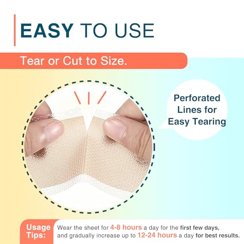 Silicone Scar Sheets, 1.55¡± x 78¡± - 2M Roll, Reusable Silicone Scar Tape, Medical Scar Strips for C-Section, Keloid Bump, Stretch Marks, Burn, Acne, Tummy Tuck, Surgical Scar Removal