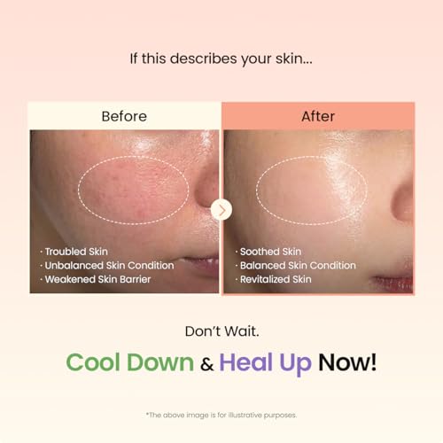 beplain Mung Bean Skincare Duo - Serum & Soothing Cream | Fragrance-Free | Soothing Care with Mung Bean | Korean Skin Care | Suitable for Sensitive Skin