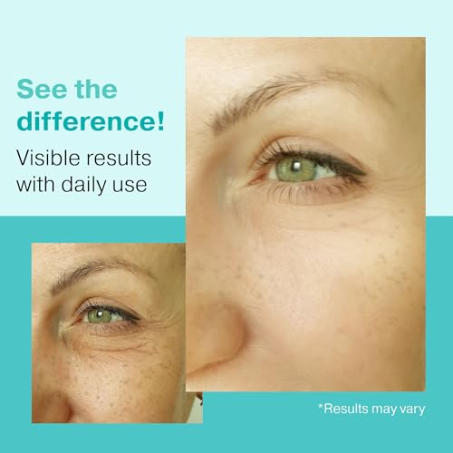 Vitamasques Golden Hydrogel Eye Pads For Puffy Eyes & Dark Circles ? Refresh in 15 minutes - Formulated in Korea - 32 Pairs / 64 HydroGel Eye Pads
