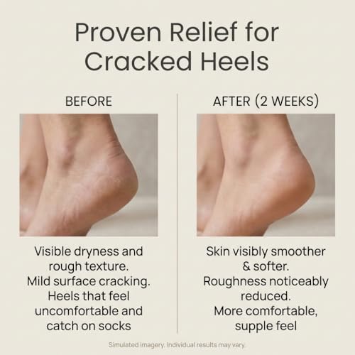 SEACRET Minerals Foot Cream, Enriched with Shea Butter, Tea Tree Oil and Dead Sea Minerals, 3.4 Fl Oz / 100 ml