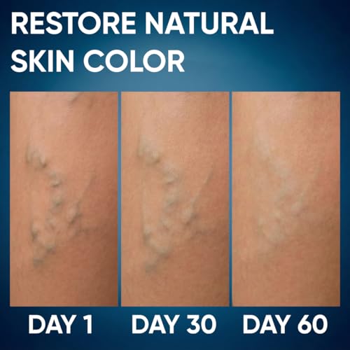 Ayurvedic Leg Cream for Men & Women | Ashwagandha & Aloe Formula | Natural, Non-Sticky Cooling Cream for Tired, Swollen-Looking Legs, Pack of 1