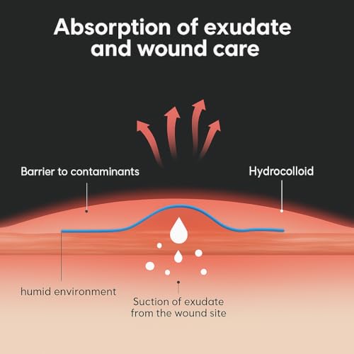 Clear Scar Sheets ? 10 Pieces ? Skin Patches for Face and Body ? Use Before Scars Fully Form ? Prevent and Reduce Scars from Acne, Scalds, Burns, Cuts, Abrasions ? Thin, Flexible, Waterproof, Gentle