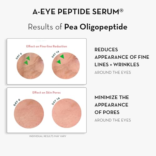 Sonage A-Eye Peptide Serum: for Dark Circles, Puffiness, Under Eye Bags, Wrinkles & Fine Lines | Anti-aging Serum for Eyes