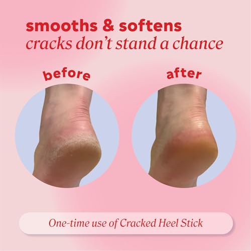 Onyx Professional Cracked Heel Repair Balm Stick for Dry Cracked Feet Treatment, Coconut Scent, 1 pack - Moisturizing Foot Balm, Rolls On, Cracked Heel Treatment