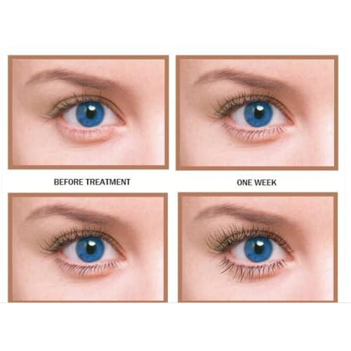 Organic NatureCall Castor Oil Serum for Eyelash, Eyebrow Growth, Mascara Tube, and Hair Treatment (10ml, Pack of 2)