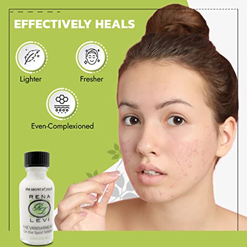 Acne Spot Pimple Drying Lotion - For Face and Body Use, Dries Out Blemishes and Pores - 1oz