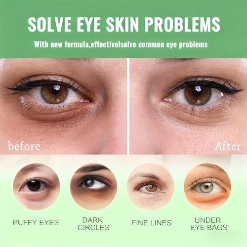firstfly Under Eye Patches - 60 PCS Aloe Vera Eye Masks for Dark Circles and Puffiness, Hydrating Eye Mask Skincare, Stocking Stuffers, Eye Patches for Women Reduce Wrinkles and Fine Lines