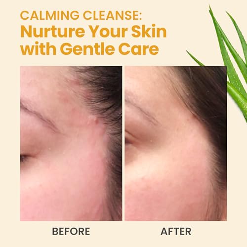 Honeyskin Face and Body Wash Moisturizer for Acne and Sensitive Skin Body Wash with Manuka Honey - Hydrating Facial Cleanser for Dry and Sensitive Skin and Anti-Aging Skincare for Men and Women (4oz)