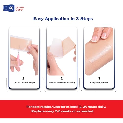 GauzeCare Silicone Scar Tape ? 1.6¡±x120¡± Roll ? Medical-Grade, Reusable, Professional Silicone Scar Tape for surgical scars, C-Section, Burns, Keloid, and Acne Scars