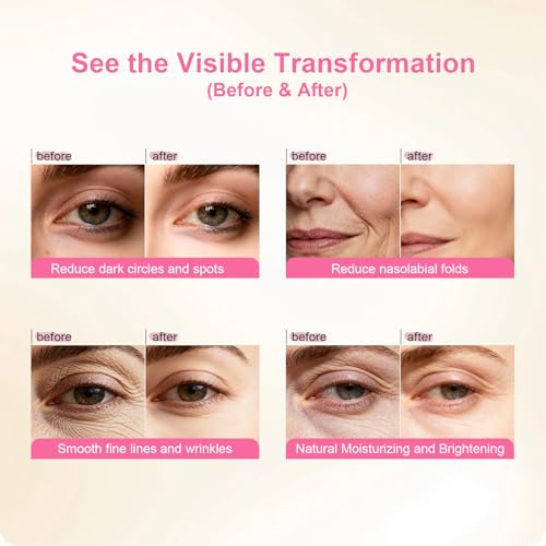 Collagen Firming Anti-Wrinkle Butterfly Eye Masks with Hydrolyzed Collagen & Niacinamide ? Hydrogel Under Eye Patches for Dark Circles, Puffiness, and Fine Lines ? 5 Pairs per Pack