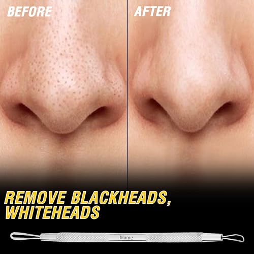 Blackhead Remover Pimple Popper Blemish Comedone Extractor Acne Tool Pimple Spot Popper Komedon Double Side Soft Touch and No-Slip Skincare for Whitehead Removal -Stainless Steel, Silver (BM29)