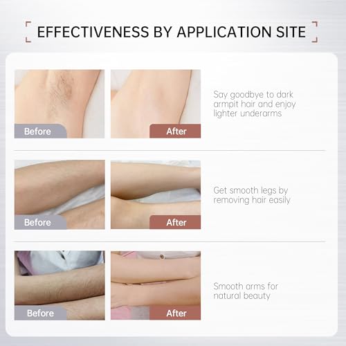 VGO Painless Bikini Gel for Women & Men, Unwanted Hair Removal for All Skin Types, 120ml / 4.06oz