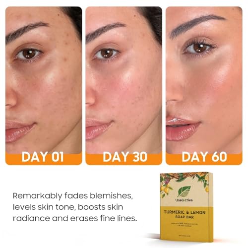 Lemon & Turmeric Glow Soap Bar for Dark Spots Remover, Powered by Kojic Acid & Vitamin C for Brightening & Fading Acne Scars - 3x Moisturizing with Shea Butter - SLS Free