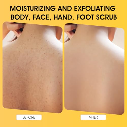 Turmeric Body Scrub, 10% AHA/BHA & Vitamin C Exfoliating Body Scrub, Body Exfoliator for Body Hand Foot Bikini Area, Smooth & Moisturized Skin for Women and Men - 11.3oz