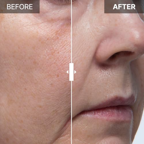 FRANZ Stem Care 10% Ampoule Serum for Face ? Stem Cell Conditioned Media (100,000ppm). Daily Revitalizing, Barrier Support, Firming, Hydrating. Advanced Liposome Delivery (1ml, 0.034 fl.oz.)