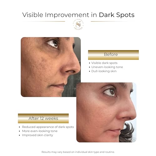 Dark Spots Corrector & Hyperpigmentation Treatment Cream for Face ? Uneven Skin Tone Repair Moisturizer with Intense Hydration, Alpha Arbutin, Kojic Acid & Vitamin C ? For Men & Women 2 oz