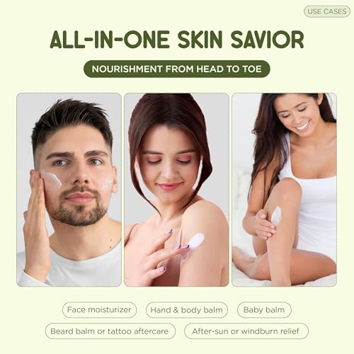 Grass-Fed Beef Tallow Balm ? 100% Natural Face & Body Moisturizer ? 4 Oz - Nourishing Skin Cream with Vitamin E, Manuka Honey & Organic Jojoba Oil ? Toxin-Free, Handmade in Small Batches