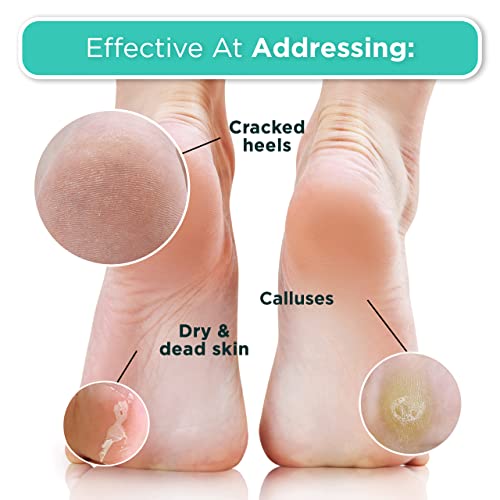 DERMORA Foot Peel Mask | Skin Exfoliating Foot Masks | Dry, Cracked Feet, Callus, Dead Skin Remover | Baby Soft Feet | Original Scent | Pack of 8 | Regular