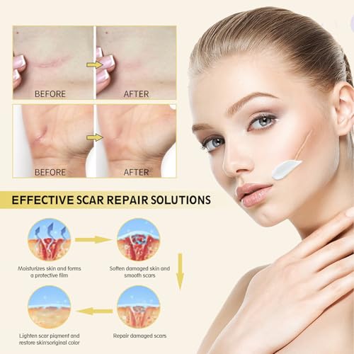 Advanced Scar Cream, Silicone Gel for Scars, Professional Scar Removal Cream for Surgical Scars, Stretch Marks, Old and New Scars, Keloids, Acne, Burns, 2 oz(60ml)