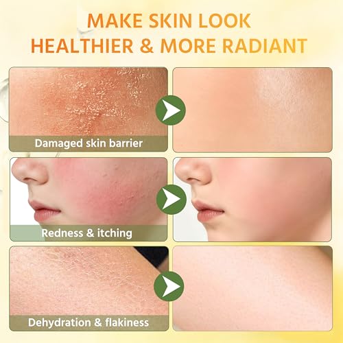 Beef Tallow for Skin, 100% Grass-Fed Whipped Tallow Balm ? Organic Moisturizer for Face & Body ? Deep Hydration for Dry & Sensitive Skin ? Natural Tallow Cream