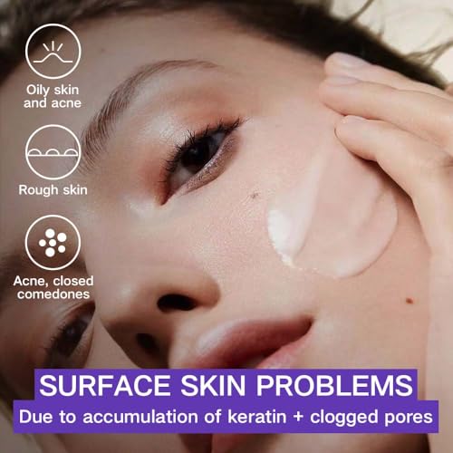 Gentle Exfoliating Face Wash,facial exfoliating agent,Suitable for sensitive acne skin cleansing,containing natural plant extracts,men's and women's exfoliating facial cleanser 2.82oz (2 Pack)
