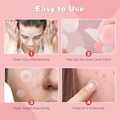 Acne Clear Hydrocolloid Patches with Powerful Blend Of Salicylic Acid, Tea Tree Oil & Centella Asiatica for Treating Zits, Blemishes & Stubborn acne. Fast-Acting Acne Care (72 patches)