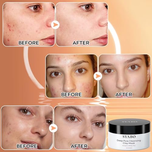 Amazonian White Clay Refreshing Pore Mask, Blackhead Remover for Face, Resurfacing Mask 200ml (7.05 Fl Oz)