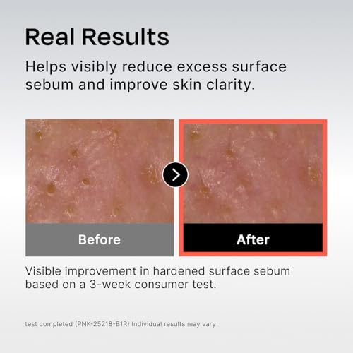 Celladix Sebum Rebalancing Rx 131 Ampoule | Pore Clearing Serum | Tighten Enlarged Pores | Repair Skin Barrier | Rapid Soothing for Daily Use | Oily & Combination Skin| 1.01 Fl Oz (Pack of 2)