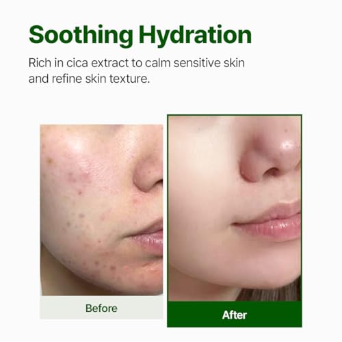NACIFIC CICA PDRN First Toner 5.07 fl oz 150ml, Centella Asiatica & PDRN for Sensitive Skin, Cooling Spot Toner, Balancing & Soothing Korean Skincare