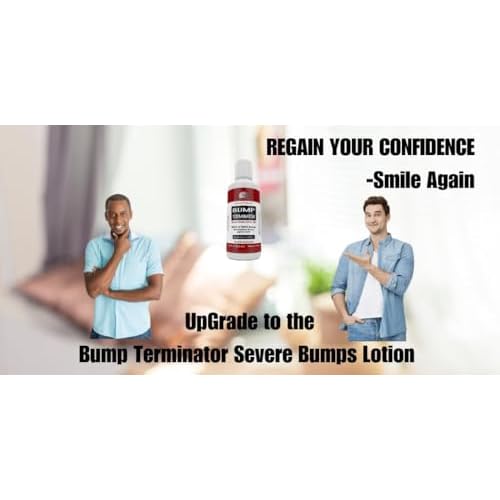 BUMP TERMINATOR Severe Bumps Treatment | Razor Bumps And Ingrown Hair Treatment | Bikini Bumps | Back of Head Bumps And Ingrown Hair Treatment, 4 oz (Pack of 1)