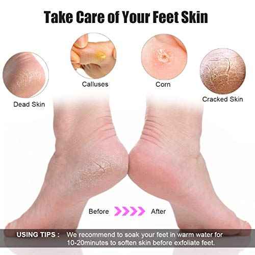 Pedicure Tools for Feet, 30 in 1 Foot Scrubber Manicure Kit for Women Men, Stainless Steel Foot File Foot SPA, Professional Callus Remover Skin Tag, Included Nail Toenail Clipper File Foot Rasp