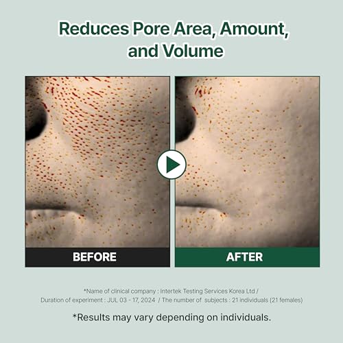 Green Rice Biome Toner Pad (5.54oz/60 Pads) with Probiotic, Exfoliating, Remove Blackheads & Whiteheads, Radiant Skin, Dual-Sided Pad for Sensitive Skin, Fragrance-Free, Vegan Korean Skincare