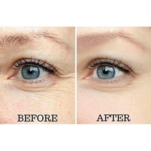 Osmotics Under Eye Rejuvenator, Anti Aging Eye Cream For Dark Circles, Eye Bags, Fine Lines, Puffiness. Best Anti Aging Eye Cream for Wrinkles, Crows feet, And Puffy Eyes