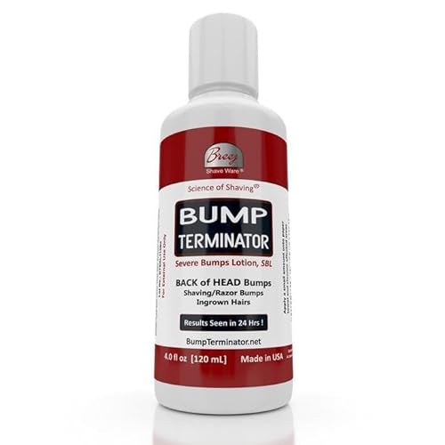 BUMP TERMINATOR Severe Bumps Treatment | Razor Bumps And Ingrown Hair Treatment | Bikini Bumps | Back of Head Bumps And Ingrown Hair Treatment, 4 oz (Pack of 1)