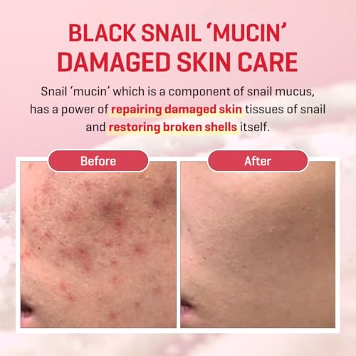 SOME BY MI Snail Trucica Miracle Repair Serum - 1.69Oz, 50ml - Made from Snail Mucin for Sensitive Skin - Daily Repair Face Serum for Post Acne Marks and Strengthen Skin Barrier - Korean Skin Care