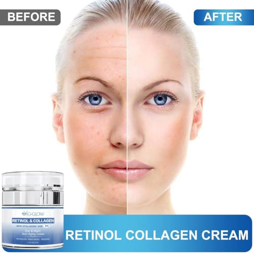 Retinol and Collagen with Hyaluronic Acid 5%, Day and Night Anti-Aging Face and Neck Cream for all type of skin, Nourishing, Moisturizing, Renewing, and firming skin, 50ml.