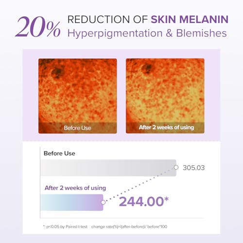 Mary&May Tranexamic Acid + Glutathione Eye Cream (30ml) - Korean Skincare for Dark Circles & Uneven tone - Fragrance-Free Under Eye Cream for Dark Spots & Hyperpigmentation 1.01oz.