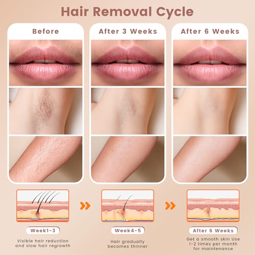 Hair Removal Device, Hair Removal for Women and Men£¬Hair Removal Body and Face for Home Use,model S3
