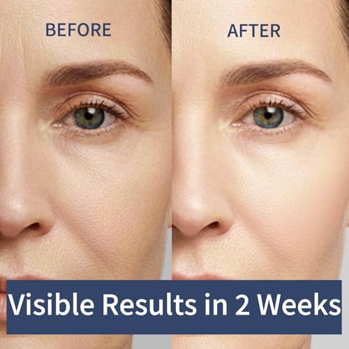 Eye Care Duo ? Calcium Multi Balm Stick & Hydrogel Under Eye Patches (60 Patches / 30 Pairs) ? Hydrating & Smoothing Eye Treatment ? Gentle, Travel-Friendly Skincare Set