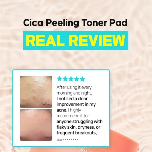 Elishacoy | TETRAFORCE Cica Peeling Toner Pads, Gentle Exfoliating & Calming Toner with Cica, Daily Skin Smoothing & Hydration, Vegan & Dermatologist Tested, 150 mL