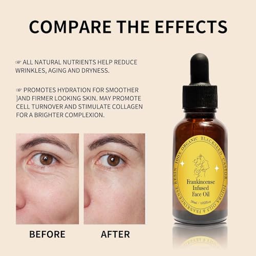 Frankincense Resin Oil for Face, Frankincense Oil for Skin, Frankincense Resin Infused Organic Black Seed, Castor & Jojoba Oil for Face, Facial Moisturizing Anti-Aging Serum (1PC, 1)