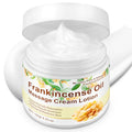 Frankincense Balm for Skin, Feet & Body ? Deep Moisturizing Cream with Pure Essential Oils ? Soothing Vitality Frankincense Balm for Anti-Aging & Skin Renewal