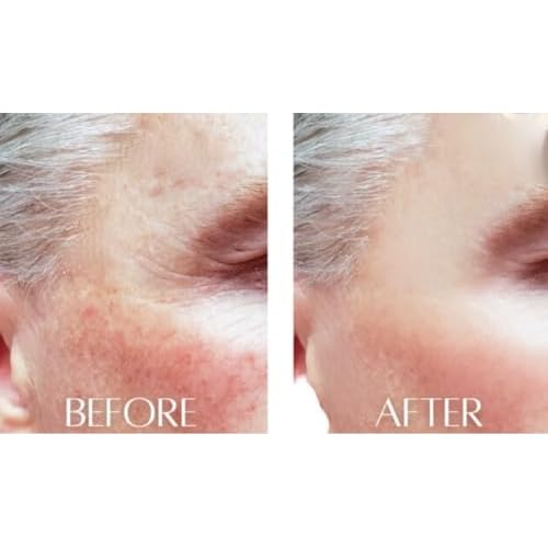 *Hyaluronic Acid Hi-C,E Antioxidant Firming Serum