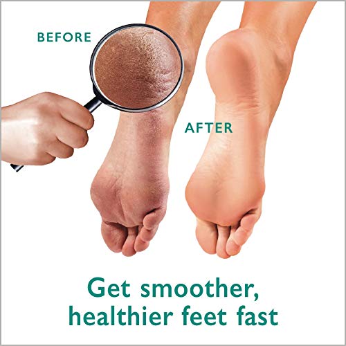 Max Strength 42% Urea Gel + Foot Scrubber + Organic Lotion Bundle